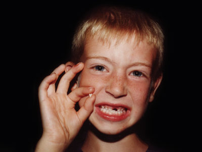young boy holding tooth he pulled
