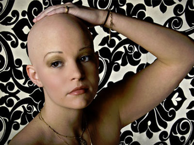 bald woman