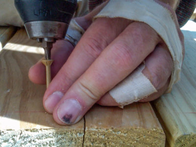 injured hand drilling screw into wooden deck